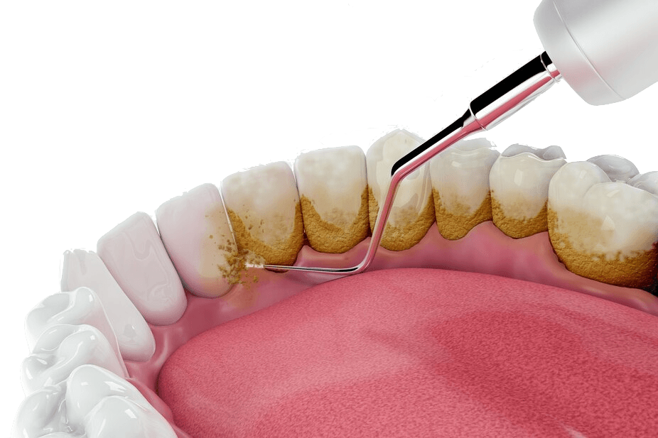 Szájhigiénés kezelések